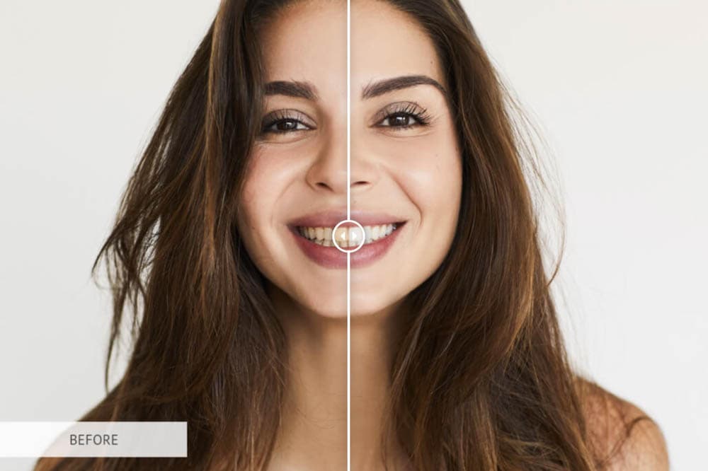 Teeth Whitening Free Photoshop Actions